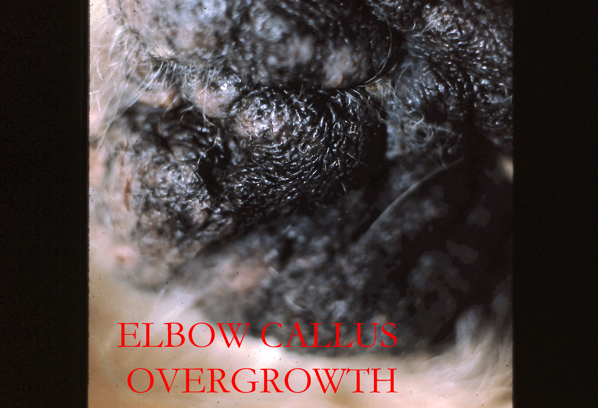 Website Elbow Callus Photo